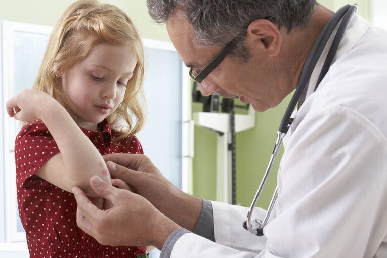 a doctor who examines a child with psoriasis