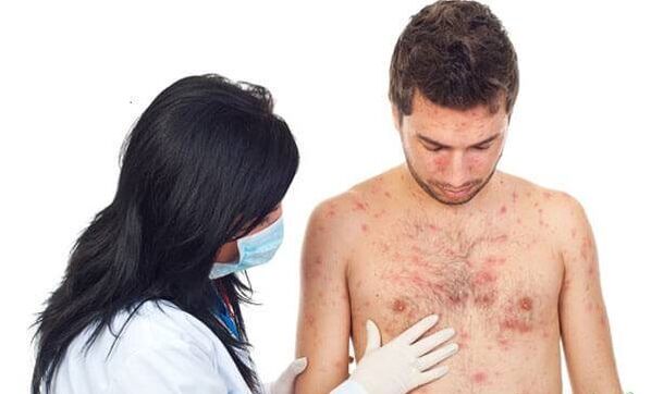 Photo by Psoriasis