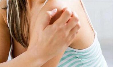 the girl scratches her shoulder